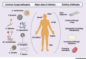 Human-Fungal-Infections-300x205.jpg