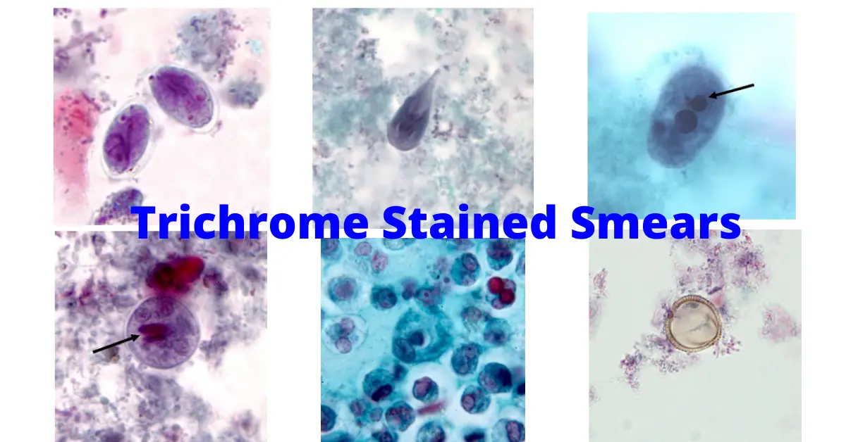 Trichrome Staining for Fecal Smears