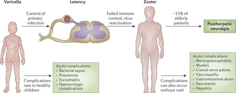 Different phases of varicella-zoster virus infection