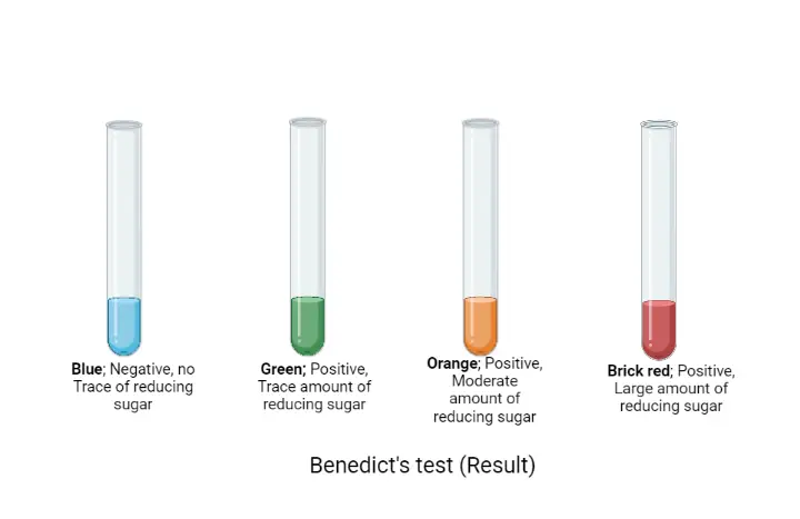 Benedict’s Test: Principle, Procedure, Uses, and Limitation