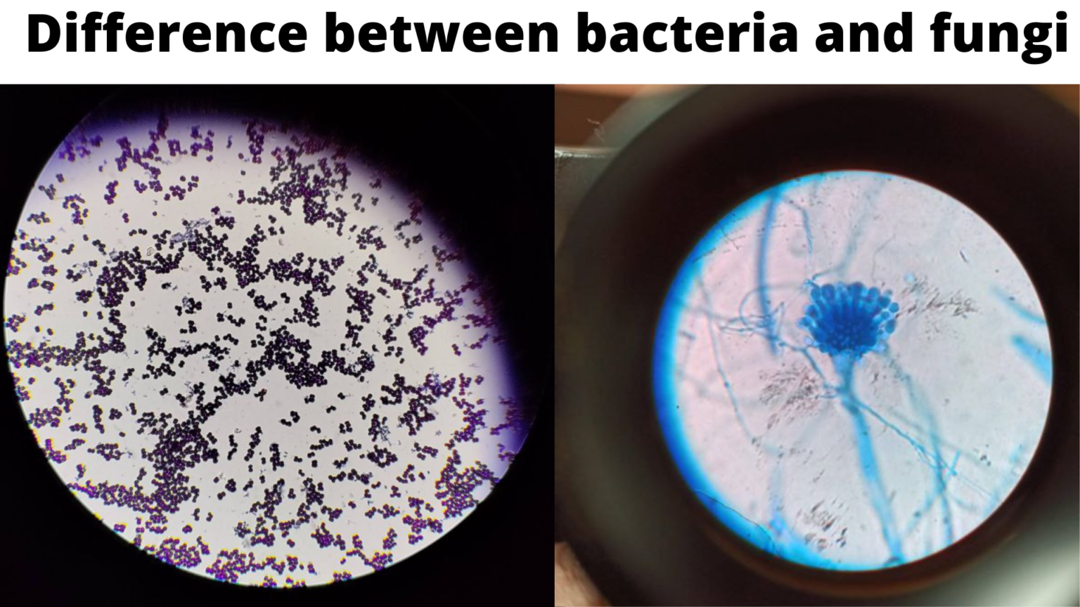 differences-and-similarities-between-bacteria-and-fungi-microbe-online