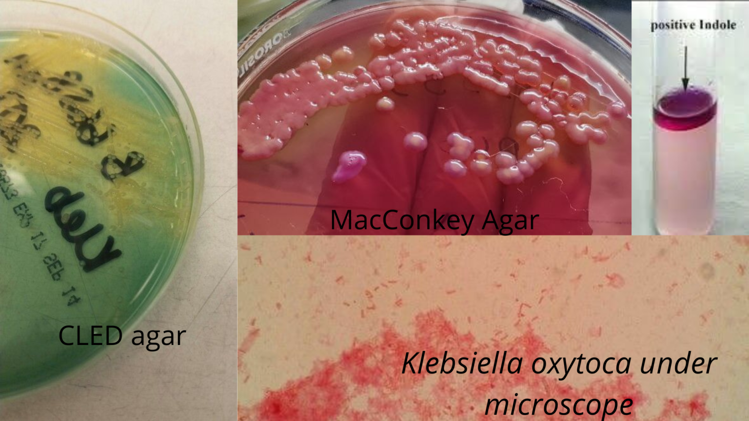 klebsiella-oxytoca-properties-and-pathogenesis-microbe-online