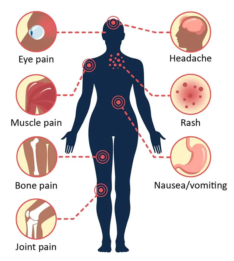 Symptoms of Dengue viral infection 