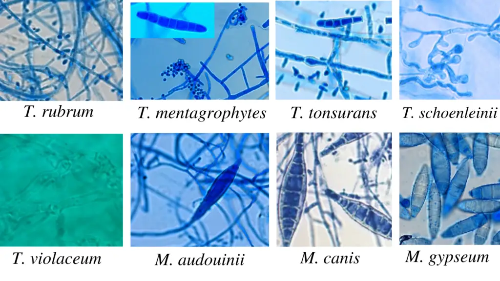 Microscopic observation of Trichophyton and Microsporum
