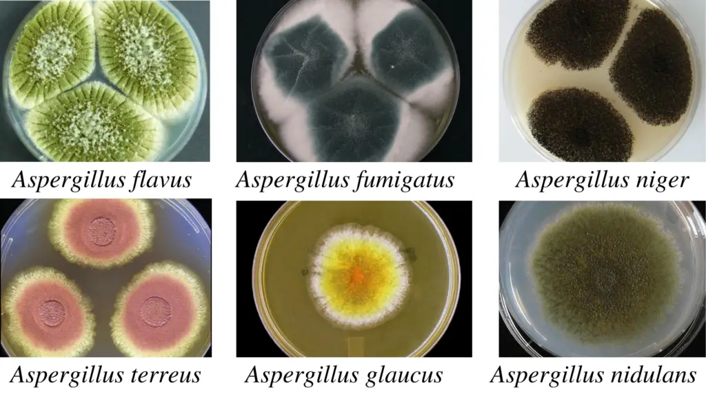 colony morphology of aspergillus spp