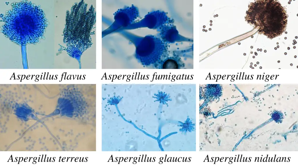 Microscopic observation of Aspergillus spp. 
