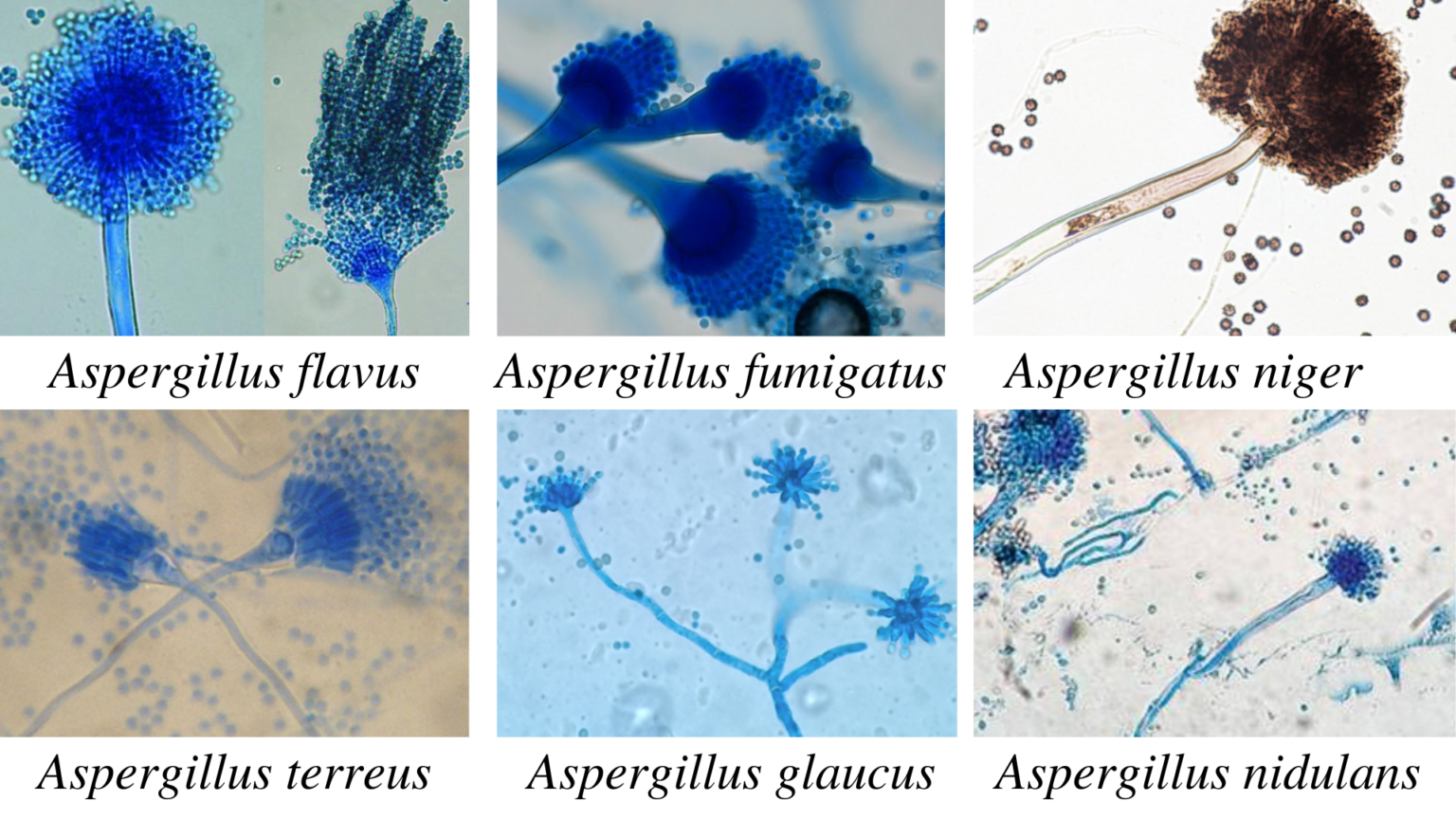 Aspergillus Morphology Clinical Features And Lab Diagnosis • Microbe Online