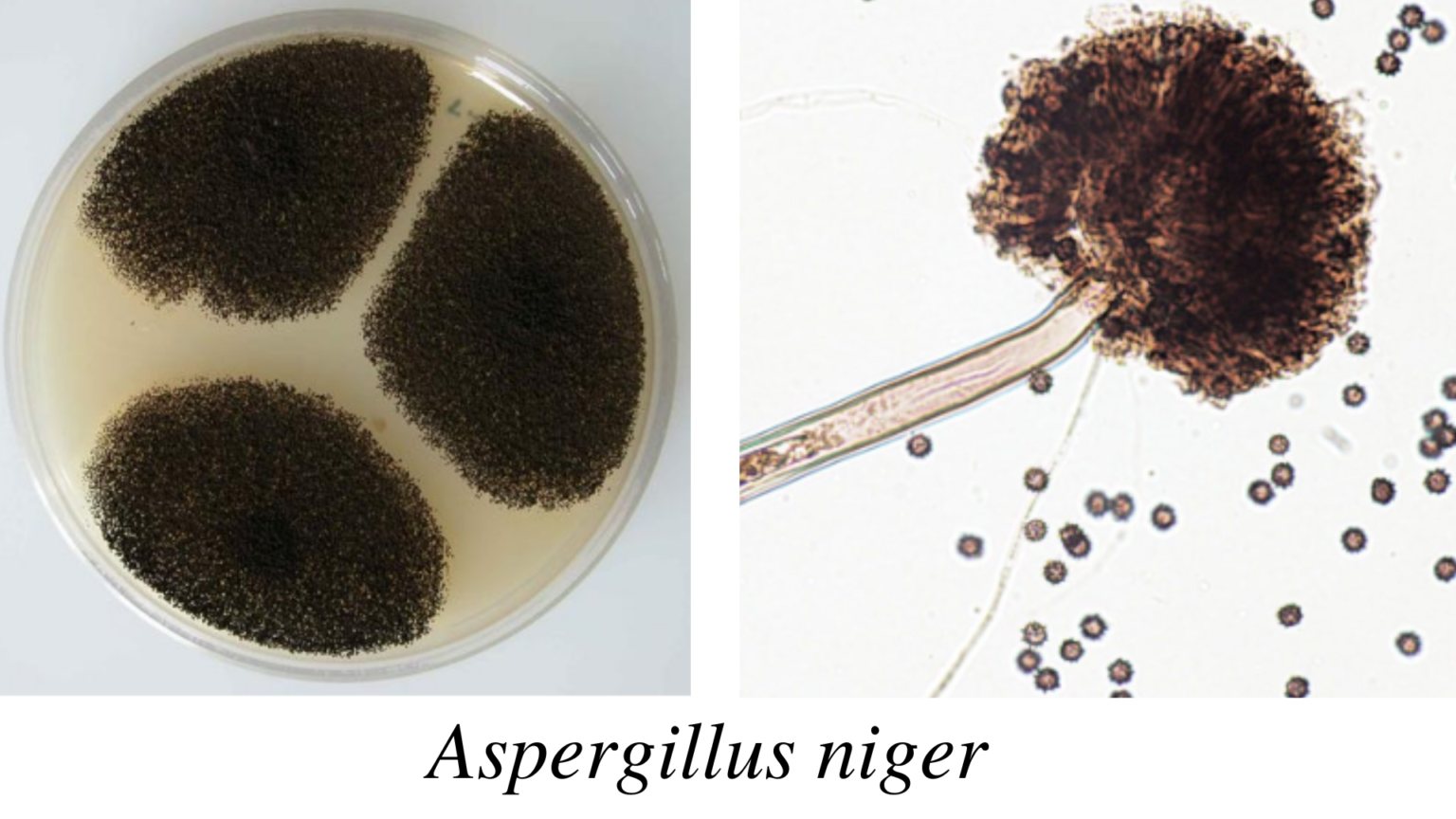 Aspergillus Morphology Clinical Features And Lab Diagnosis Microbe Online