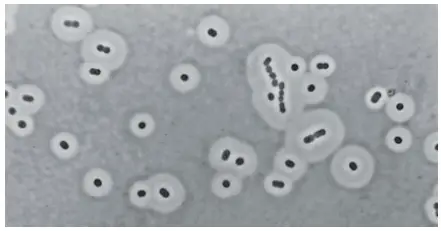 Capsules of Acinetobacter species as seen under phase-contrast microscopy after negative staining 